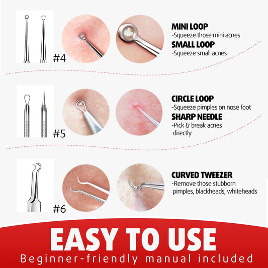 Cbiumpro Blackhead Pimple Popper Tool Kit